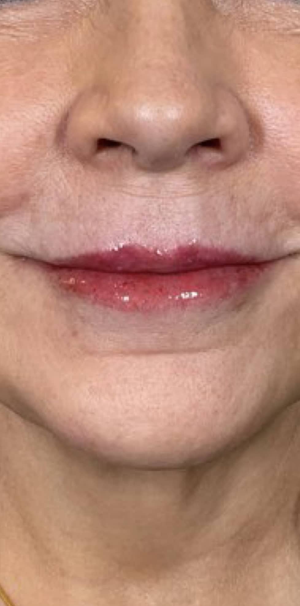 After Image: Filler - front